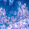 Gastroenterology