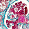 Nephrology
