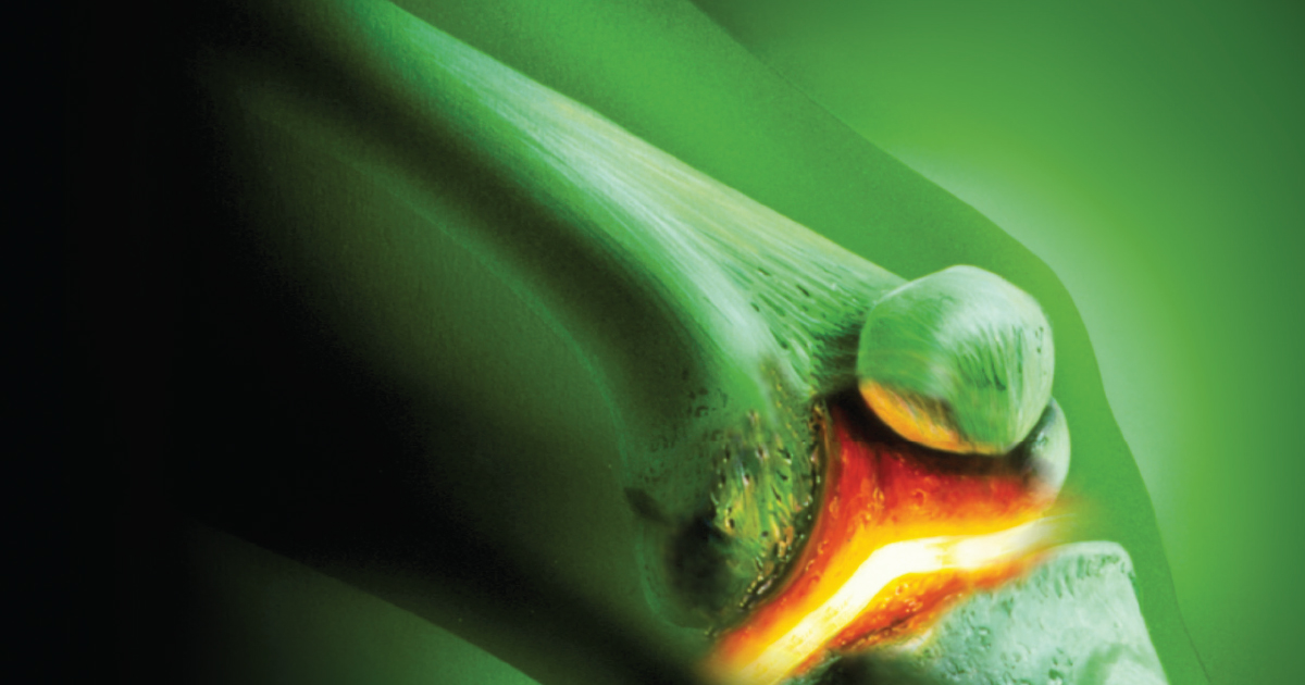 Imaging Appearances in Gout