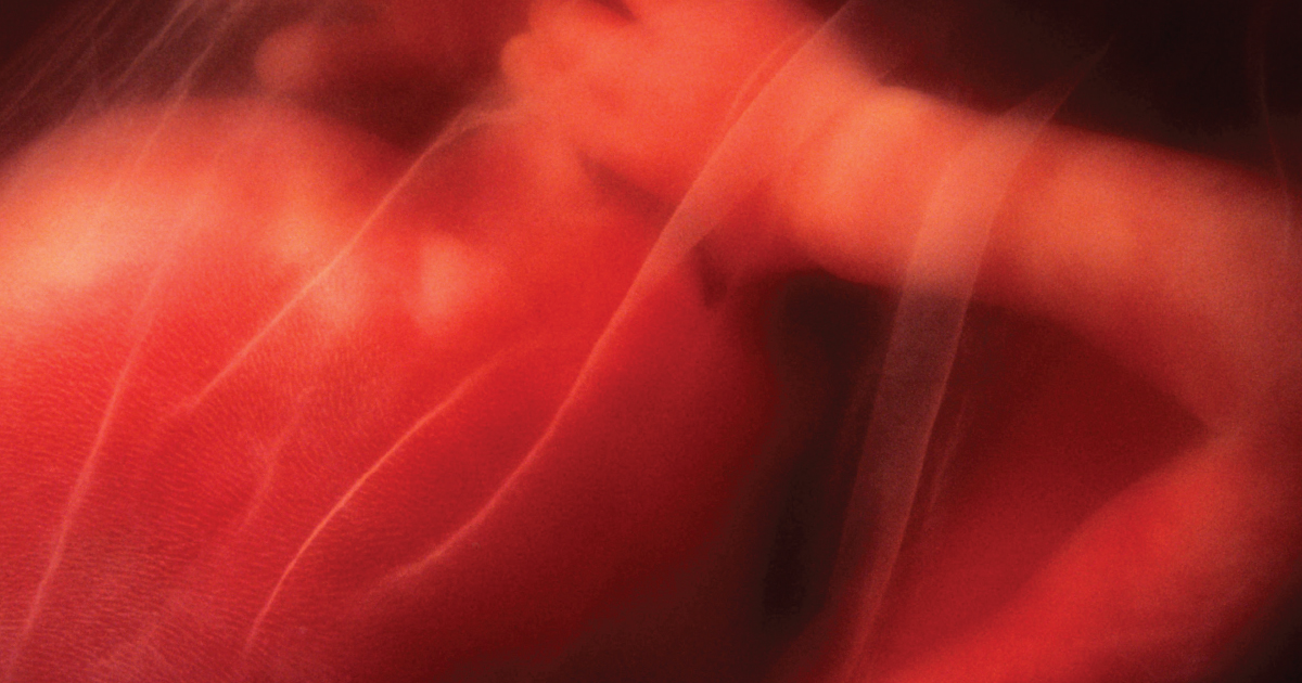 Pregnancy and Lifestyle Short and LongTerm Effects on Mother's and