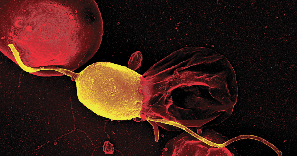 Sustained Release Formulation of Primaquine for Prevention of Relapse